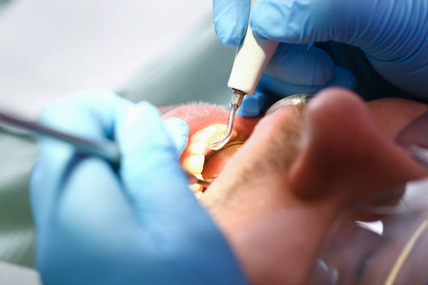 Best Tooth Pain Emergency Relief  in Thibodaux, LA