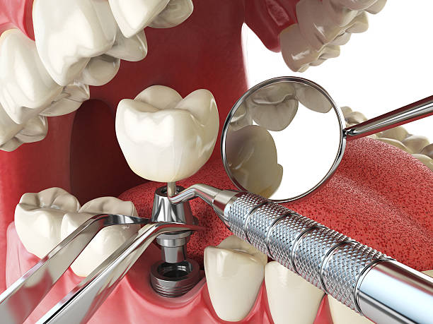Best Cracked Tooth Emergency Dentist  in Thibodaux, LA